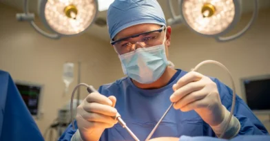 Lipoaspiração Tradicional