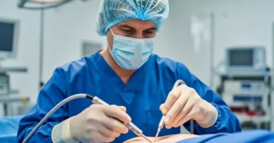 Lipoaspiração Masculina