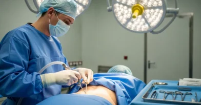 Lipoaspiração nas Costas​