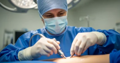 Lipoaspiração nos Braços​